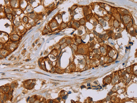 MTUS1 Polyclonal Antibody Store at -20°C