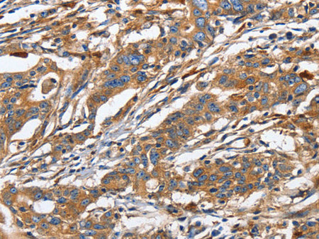 GNA13 Polyclonal Antibody Store at -20°C