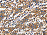 GNA13 Polyclonal Antibody Store at -20°C