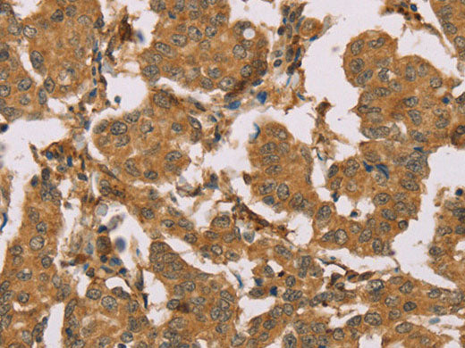 SUMO2/3/4 Polyclonal Antibody