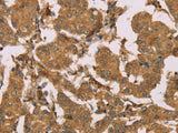 SUMO2/3/4 Polyclonal Antibody