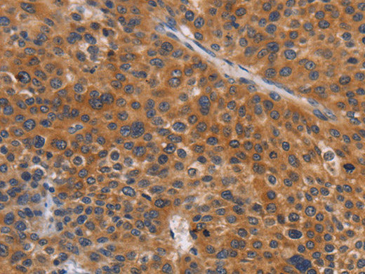NCR1 Polyclonal Antibody Store at -20°C