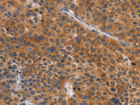 NCR1 Polyclonal Antibody Store at -20°C