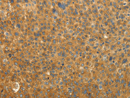 RAB35 Polyclonal Antibody Store at -20°C