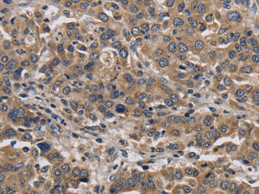 KIF22 Polyclonal Antibody Store at -20°C