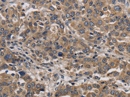 KIF22 Polyclonal Antibody Store at -20°C