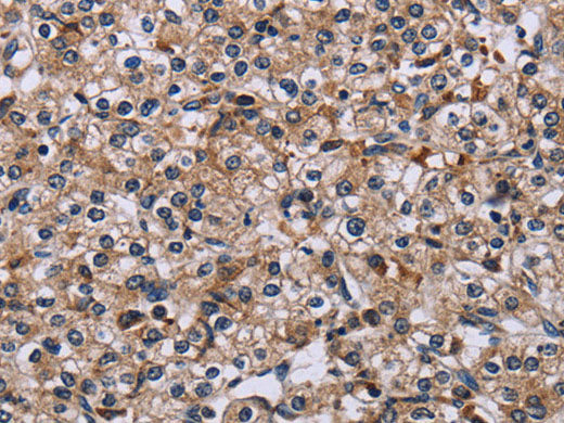 IPO4 Polyclonal Antibody Store at -20°C