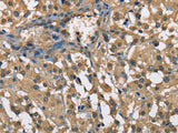 ENO1 Polyclonal Antibody Store at -20°C