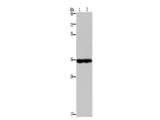 NDUFA9 Polyclonal Antibody Reactivity Human