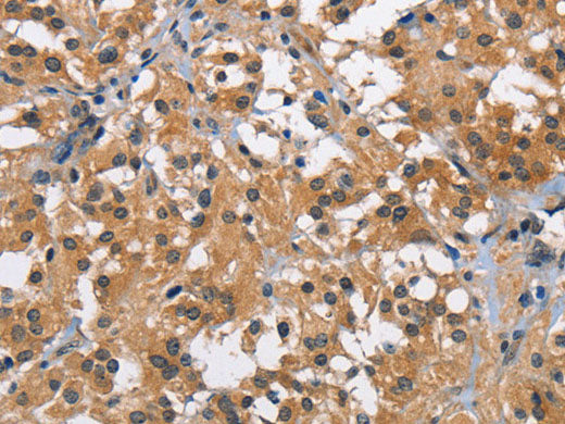 BABAM2 Polyclonal Antibody Store at -20°C