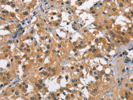 BABAM2 Polyclonal Antibody Store at -20°C