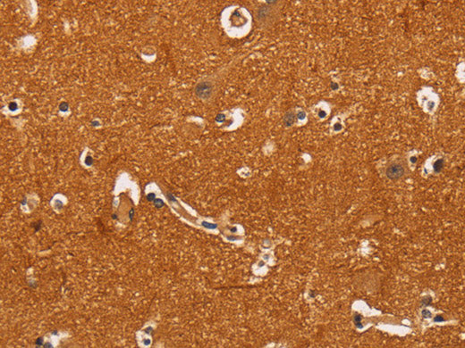 TNFRSF8 Polyclonal Antibody Store at -20°C