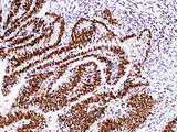 MSH2 Monoclonal Antibody Stored at 2~8°C