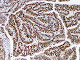MSH6 Monoclonal Antibody Stored at 2~8°C