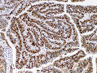 MSH6 Monoclonal Antibody Stored at -20°C