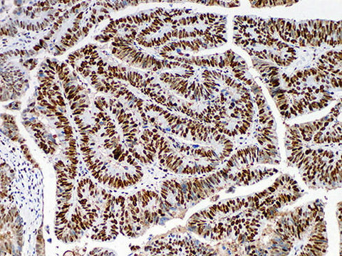 MSH6 Monoclonal Antibody Stored at -20°C