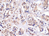 MST1/MST1/MST1/MST1/STK4 Polyclonal Antibody