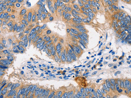 MTOR Polyclonal Antibody Store at -20°C, Biomarkers, Elabscience Biotechnology, MSE Supplies