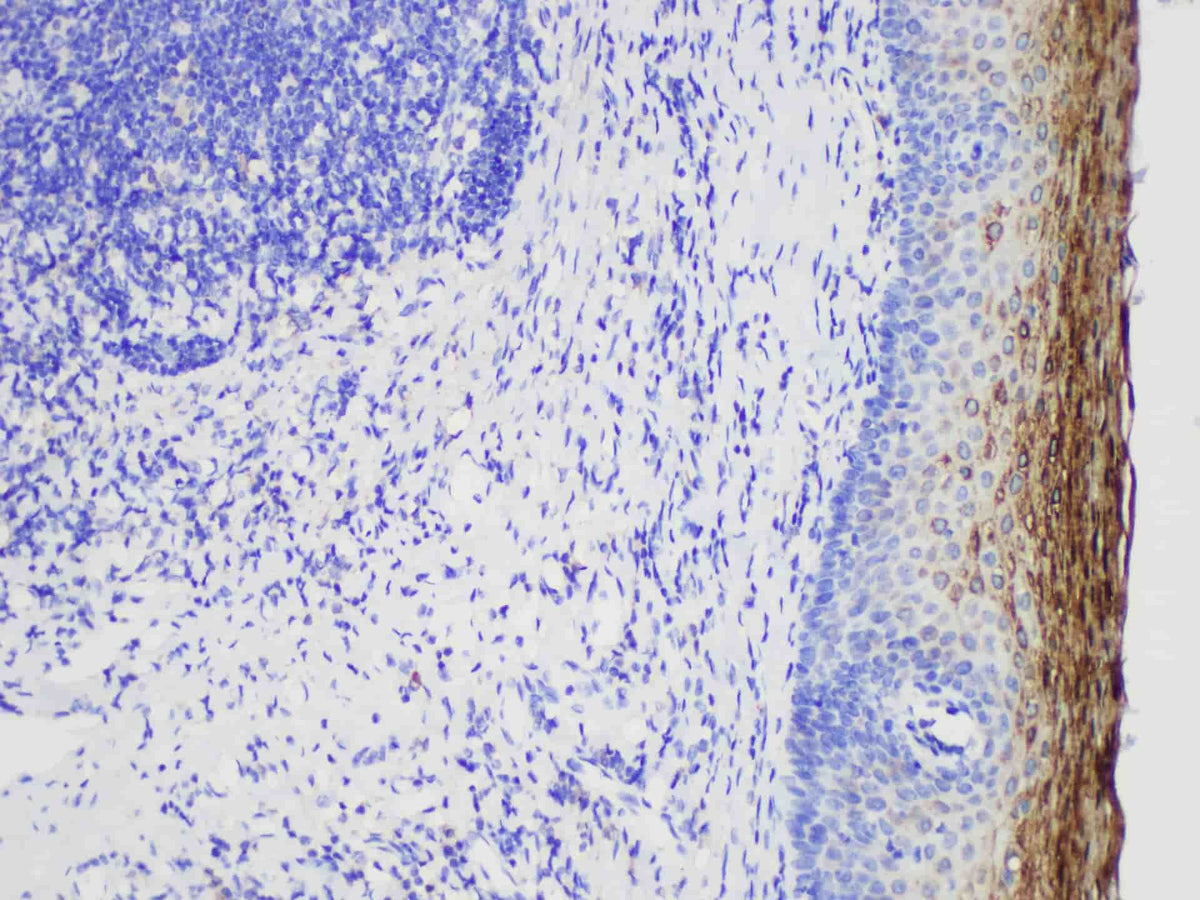 MUC1 Monoclonal Antibody Stored at 2~8°C