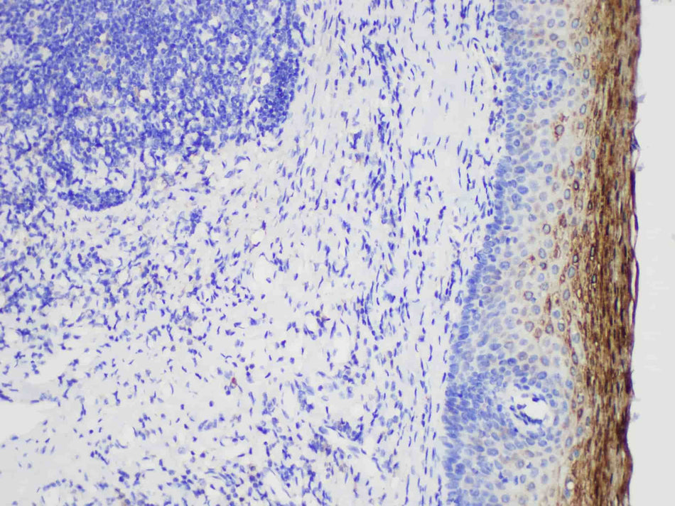 MUC1 Monoclonal Antibody Stored at 2~8°C