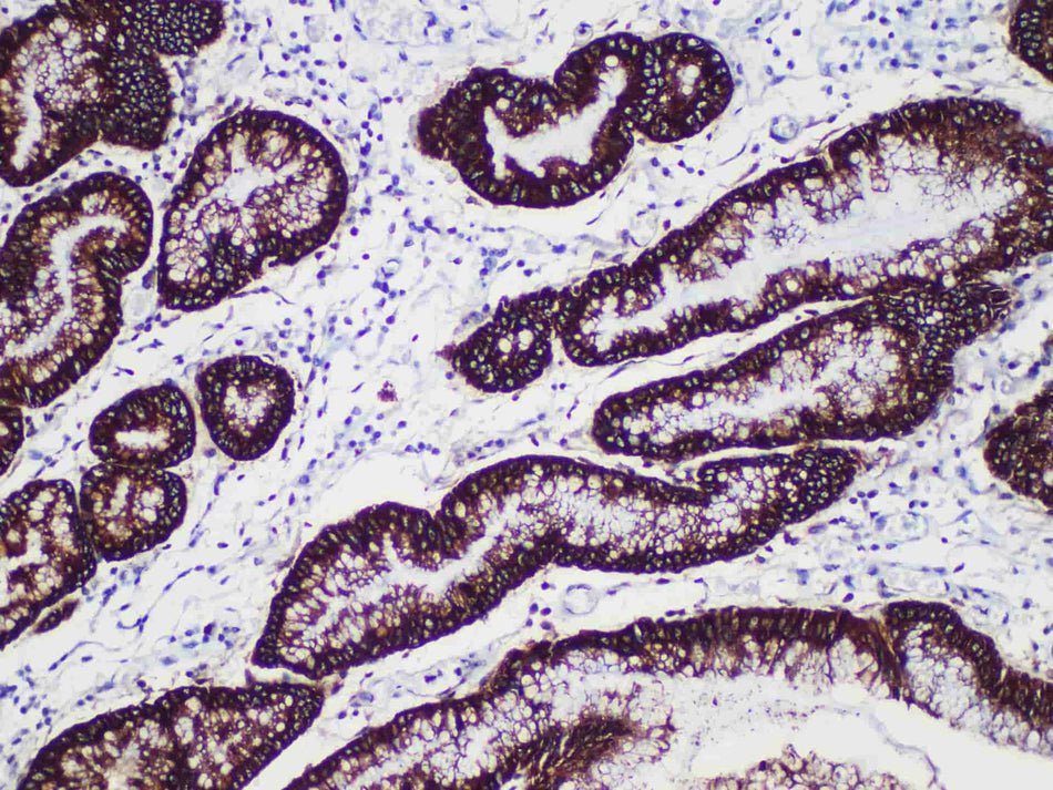 MUC5AC Monoclonal Antibody Stored at -20°C