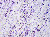 Myo D1 Monoclonal Antibody Stored at 2~8°C