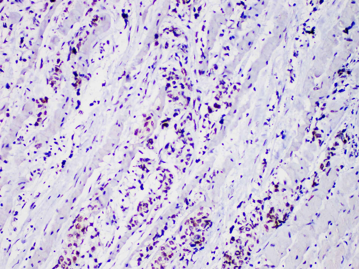 Myo D1 Monoclonal Antibody Stored at -20°C
