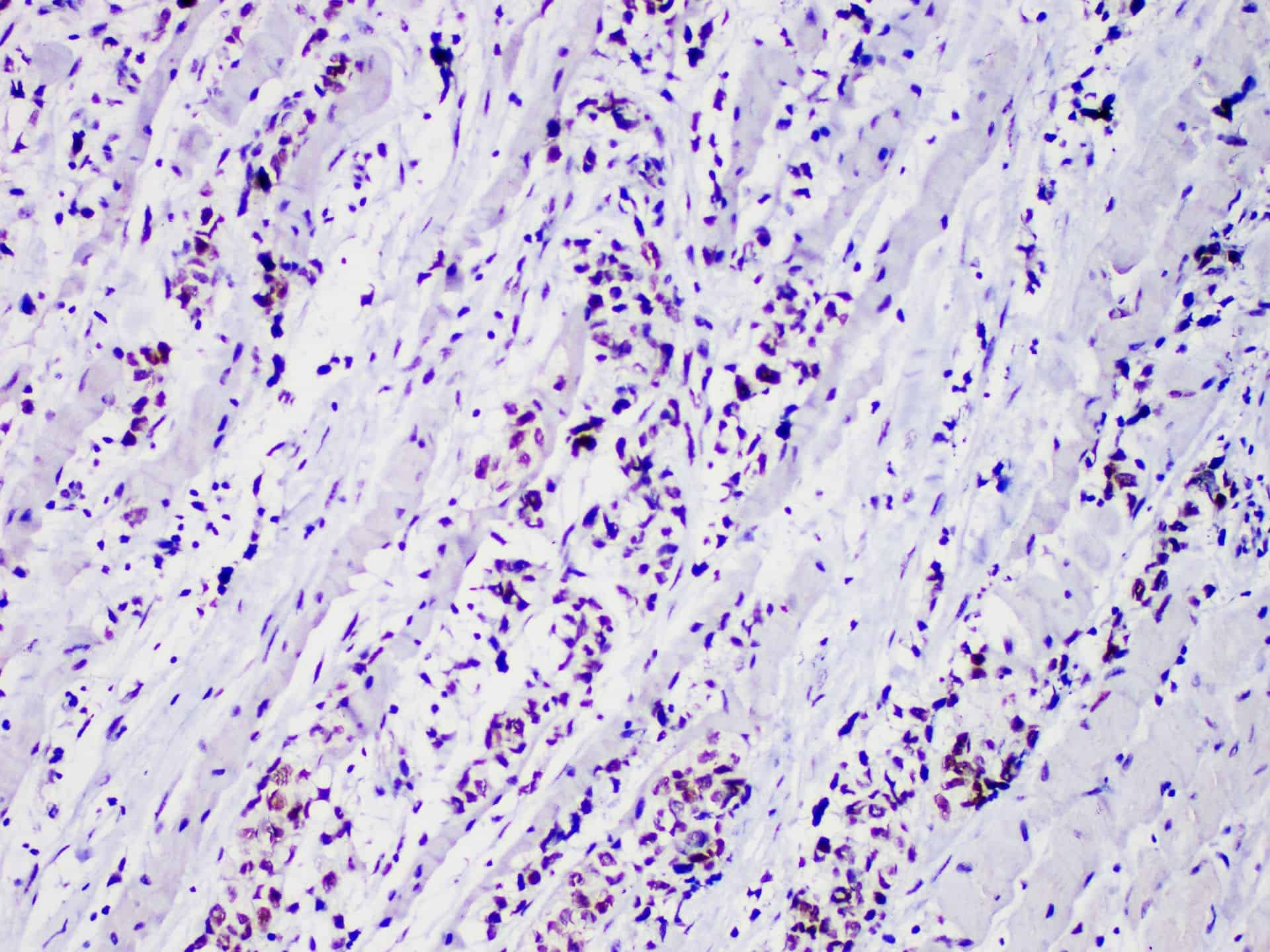 Myo D1 Monoclonal Antibody Stored at -20°C