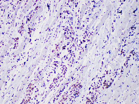 Myo D1 Monoclonal Antibody Stored at -20°C