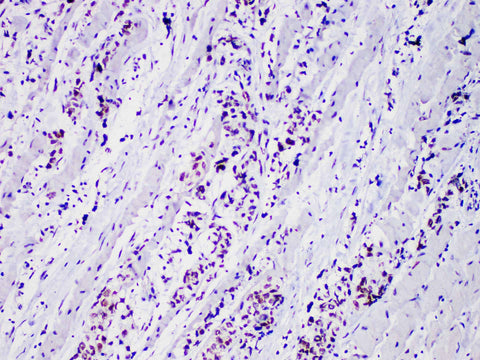 Myo D1 Monoclonal Antibody Stored at -20°C