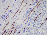 Myoglobin Monoclonal Antibody Stored at 2~8°C