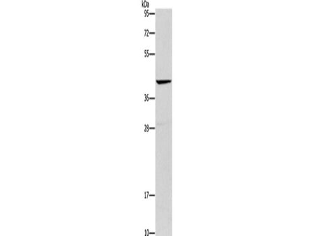 ORM2 Polyclonal Antibody Store at -20°C
