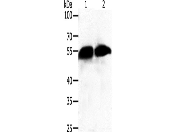 GC Polyclonal Antibody Store at -20°C