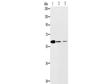 ABCE1 Polyclonal Antibody Store at -20°C