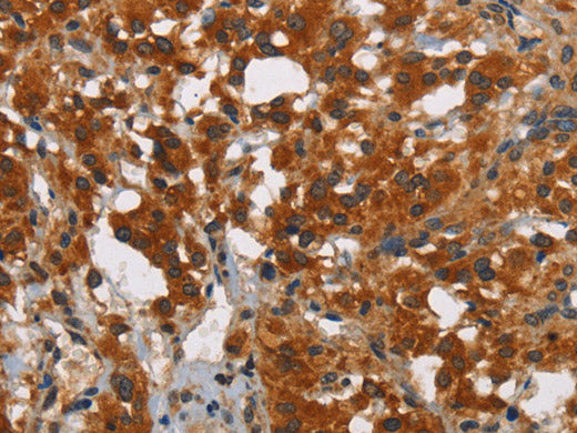 SMAD3 Polyclonal Antibody Store at -20°C