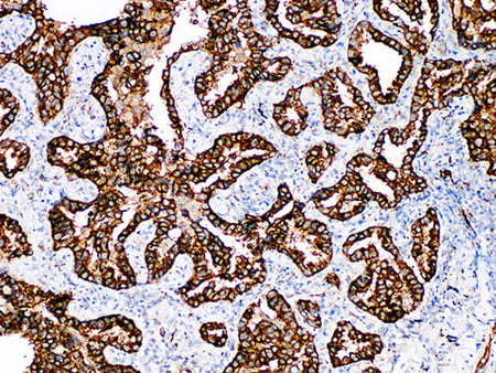 Napsin A Monoclonal Antibody Stored at 2~8°C