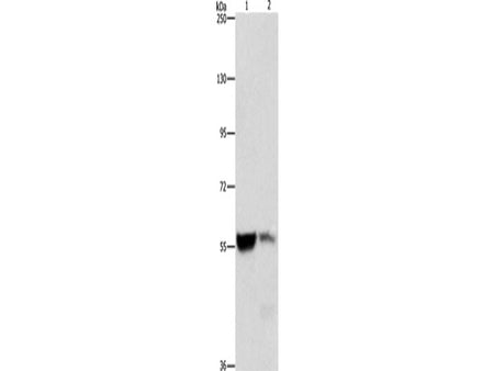 ALDH8A1 Polyclonal Antibody Store at -20°C