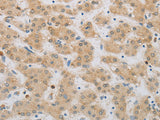 NBN Polyclonal Antibody Store at -20°C, Biomarkers, Elabscience Biotechnology, MSE Supplies