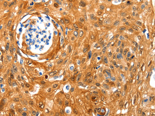 NCOR1 Polyclonal Antibody Store at -20°C, Biomarkers, Elabscience Biotechnology, MSE Supplies