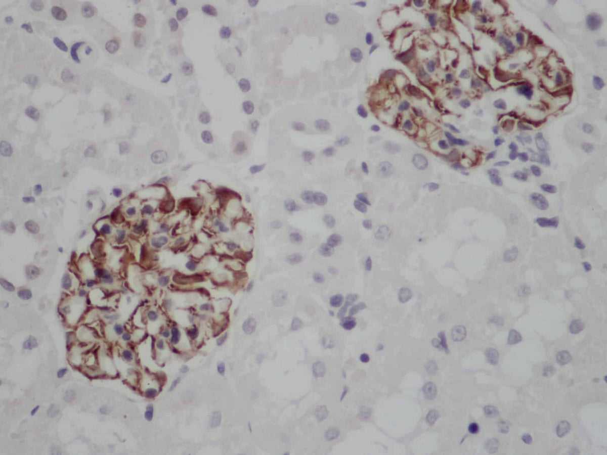 NES Polyclonal Antibody
