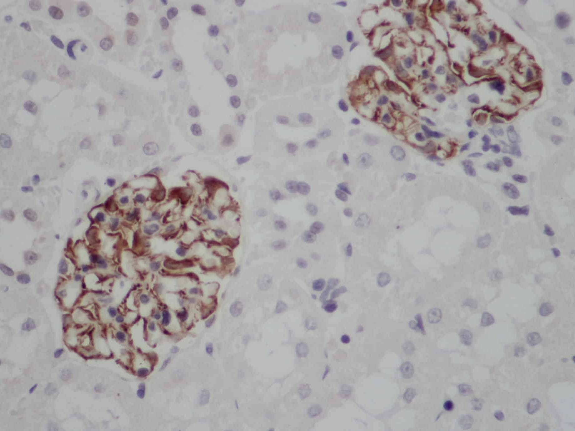 NES Polyclonal Antibody