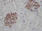 NES Polyclonal Antibody