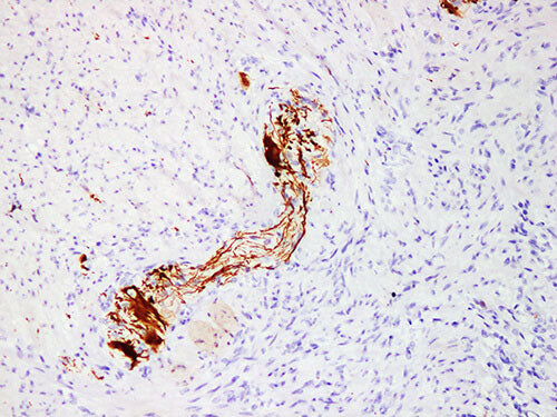 NF Monoclonal Antibody Stored at -20°C