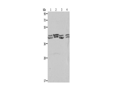 PSMD6 Polyclonal Antibody Store at -20°C