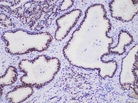NKX3.1 Monoclonal Antibody Stored at -20°C