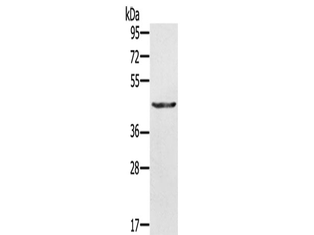 KRT31 Polyclonal Antibody