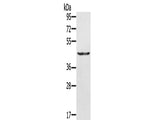 KRT31 Polyclonal Antibody