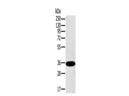 PPP2CA Polyclonal Antibody Store at -20°C