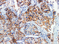 p120 Monoclonal Antibody Stored at -20°C