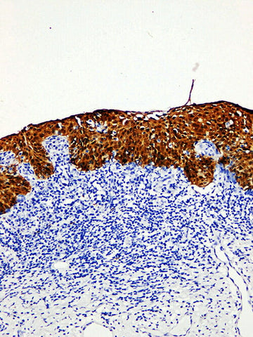 p16 Monoclonal Antibody Stored at -20°C